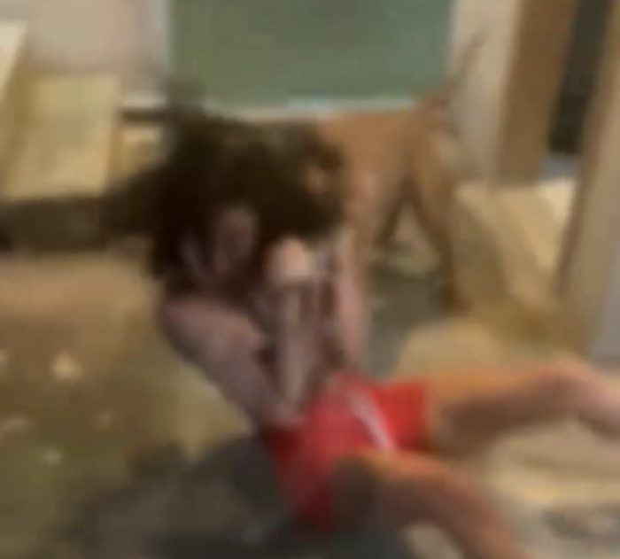 VÍDEO FORTE | Mãe manda pitbull atacar filha após descobrir que ela é do ‘job’; graves ferimentos