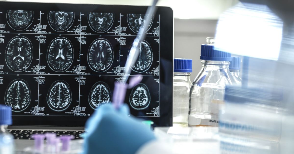 Dr. Kalil e neurologistas comentam despreparo do Brasil com envelhecimento