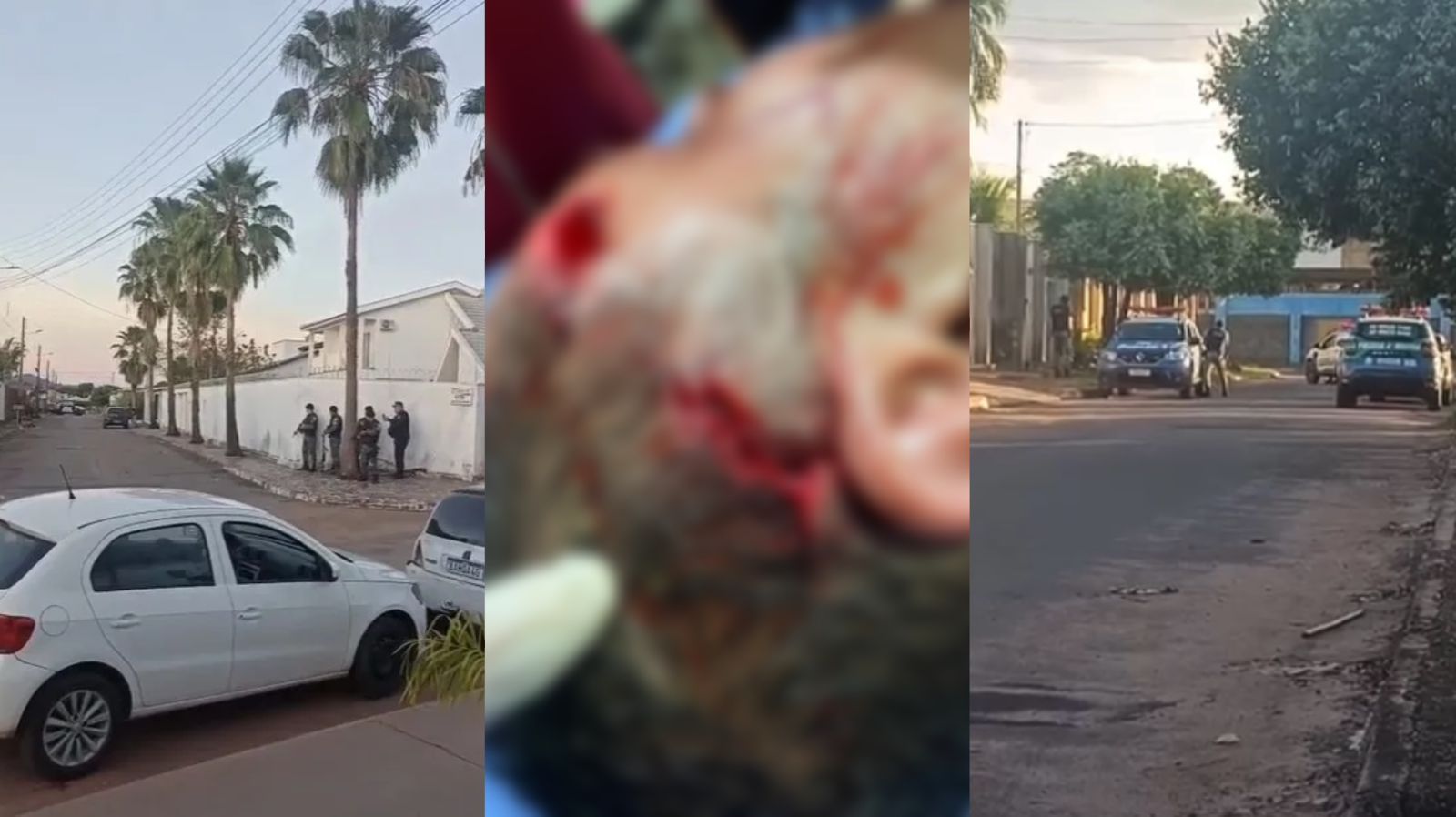 Médico surta, atira, dispara flechas contra policiais e acaba baleado na cabeça; veja