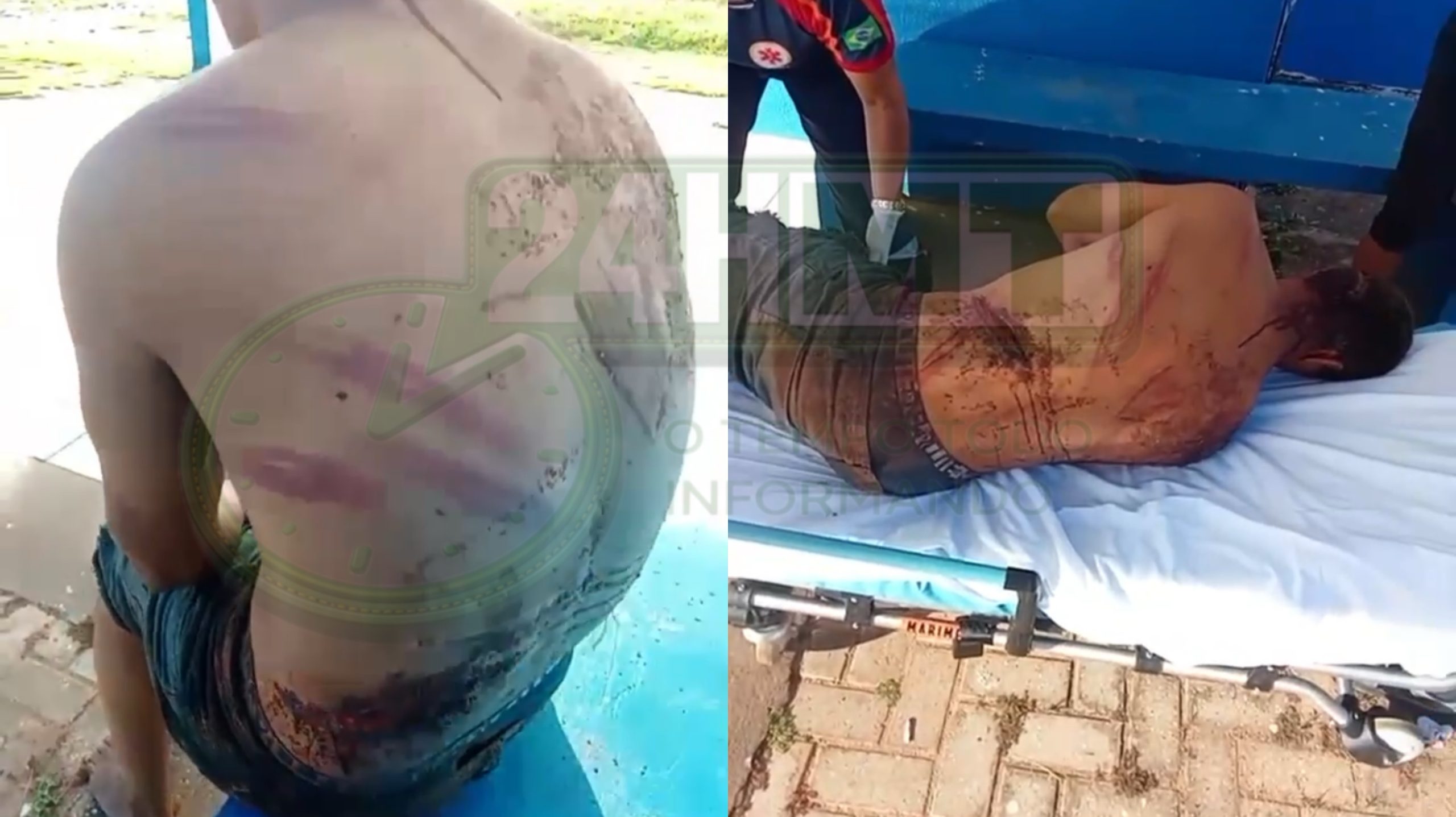 Homem é brutalmente atacado a golpes de facão e madeira e consegue fugir pela mata em Poxoréu