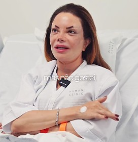 Virgínia Mendes admite que fez 'bobagem' e refaz procedimento estético