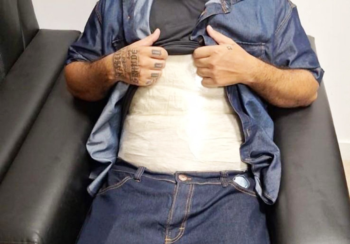 Homem é flagrado em embarque com 10 kg de coca presos ao corpo