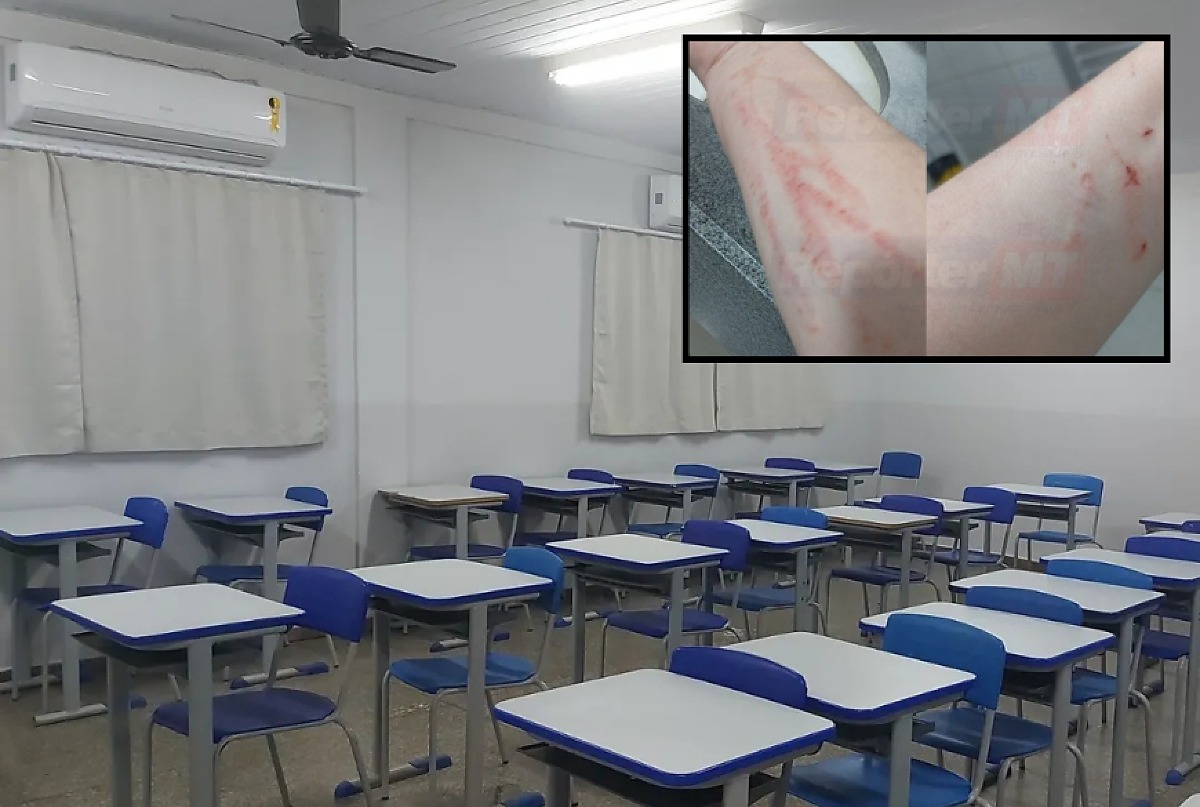 Aluno de 12 anos com autismo ataca professora com socos e mordidas e foge de escola em VG